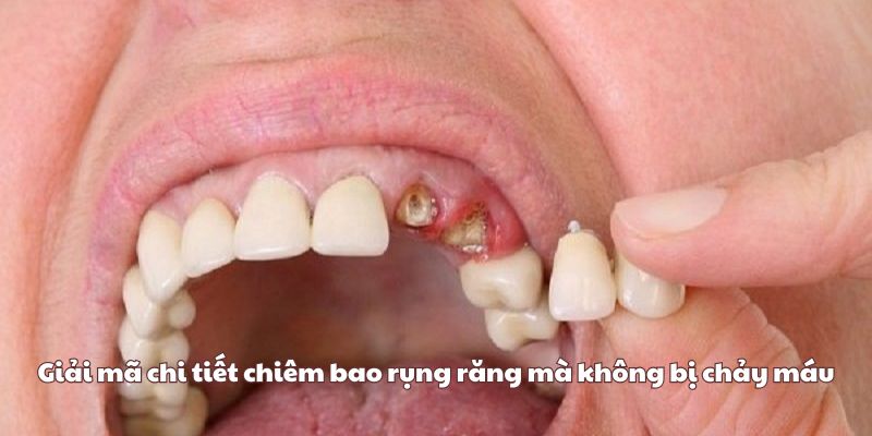 Giải mã chi tiết chiêm bao rụng răng mà không bị chảy máu